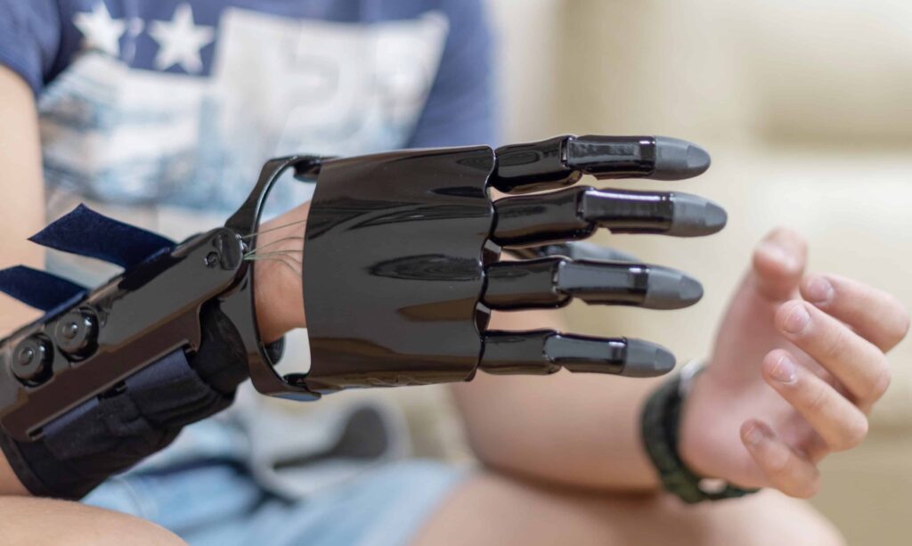 prosthetic maintenance guide by Around and About Inc