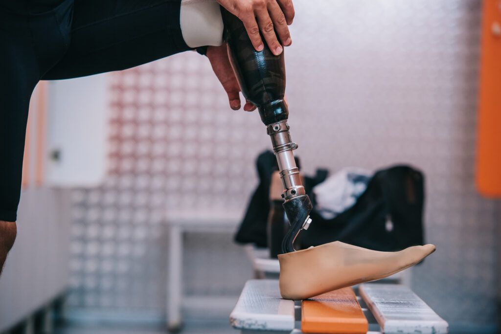 Man fitting his high-performance custom prosthetics leg before a workout session.
