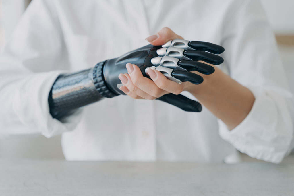 Woman adjusting her advanced custom prosthetic hand designed for everyday functionality.