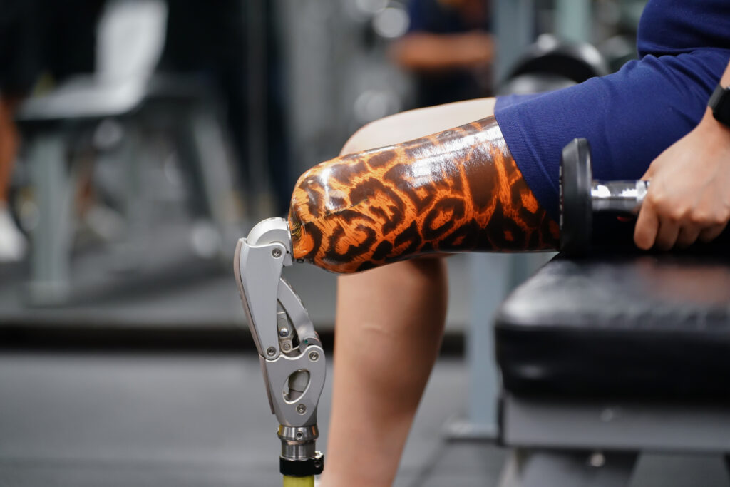 Woman with a vibrant custom prosthetic leg warming up at the gym with a dumbbell.