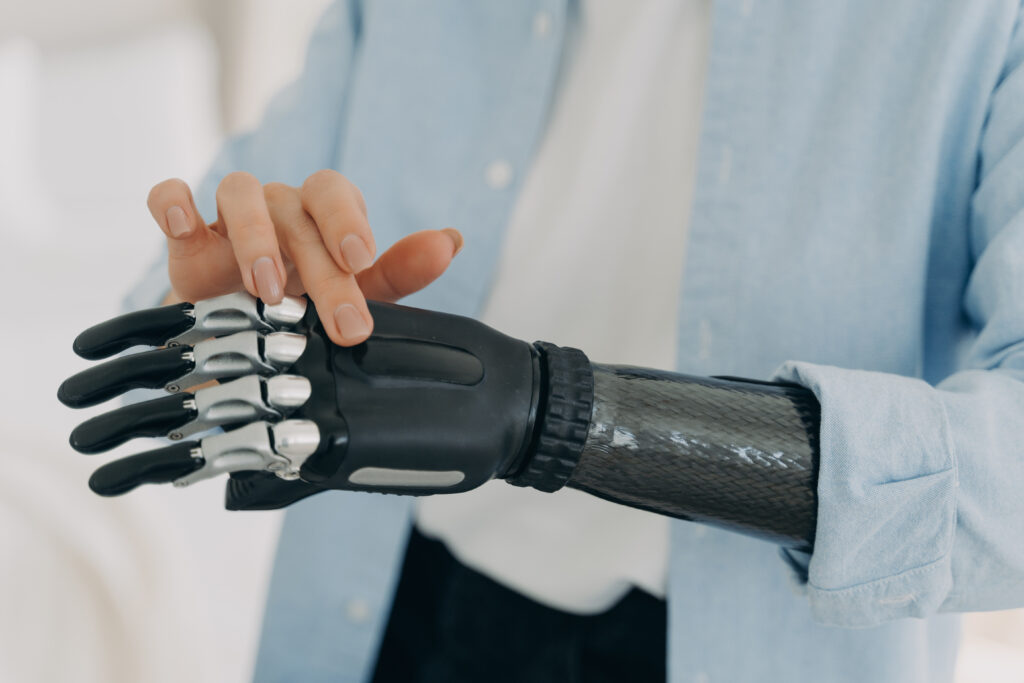 Woman examining the fingers of her advanced prosthetic arm during a comfort and mobility check