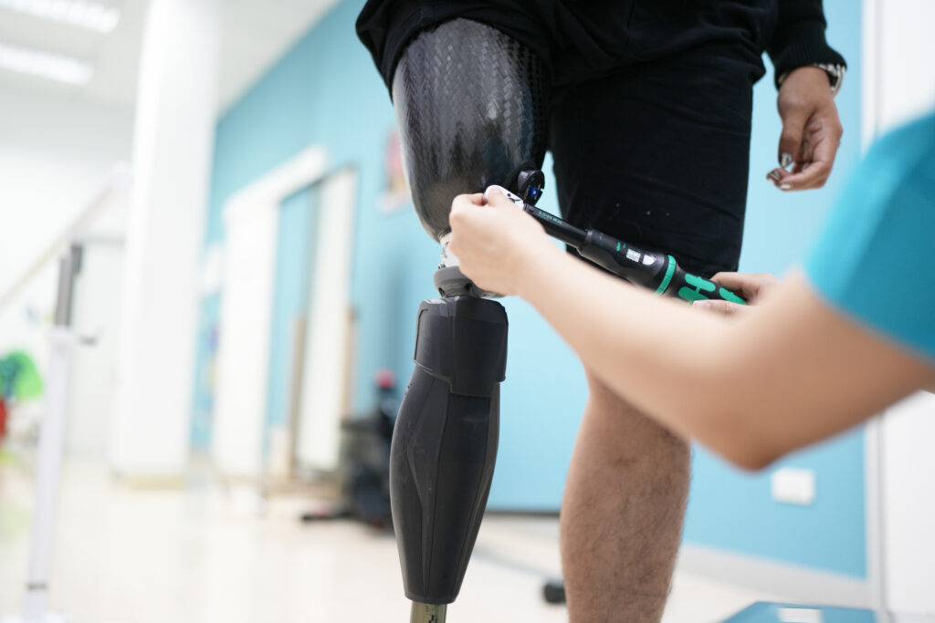 Technician adjusting a prosthetic leg during a fitting session in a clinical setting