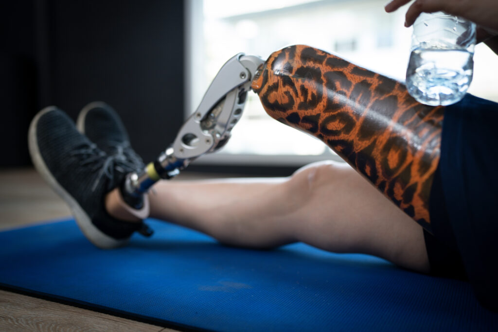 Person stretching on a mat with a custom prosthetics leg featuring a patterned socket