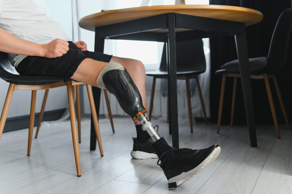 Person seated indoors with lower limb prosthetics fitted comfortably for daily use and mobility