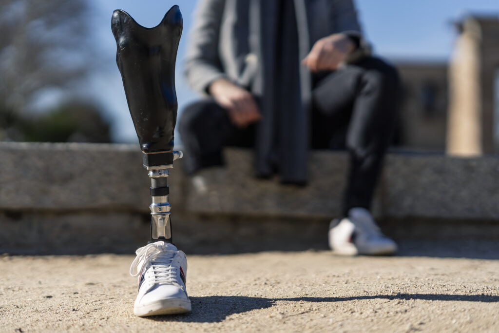 A closeup shot of a disabled young man with foot prosthetic alignment sitting outdoor