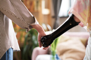 Prosthetics user holding hands with a partner, showing emotional support and confidence in daily life with a prosthetic limb