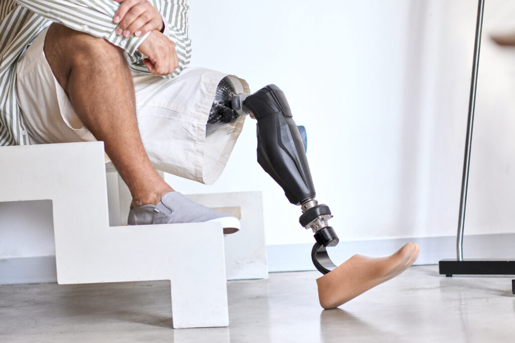 Active individual preparing prosthetics leg for outdoor activity, showcasing durability and real world mobility