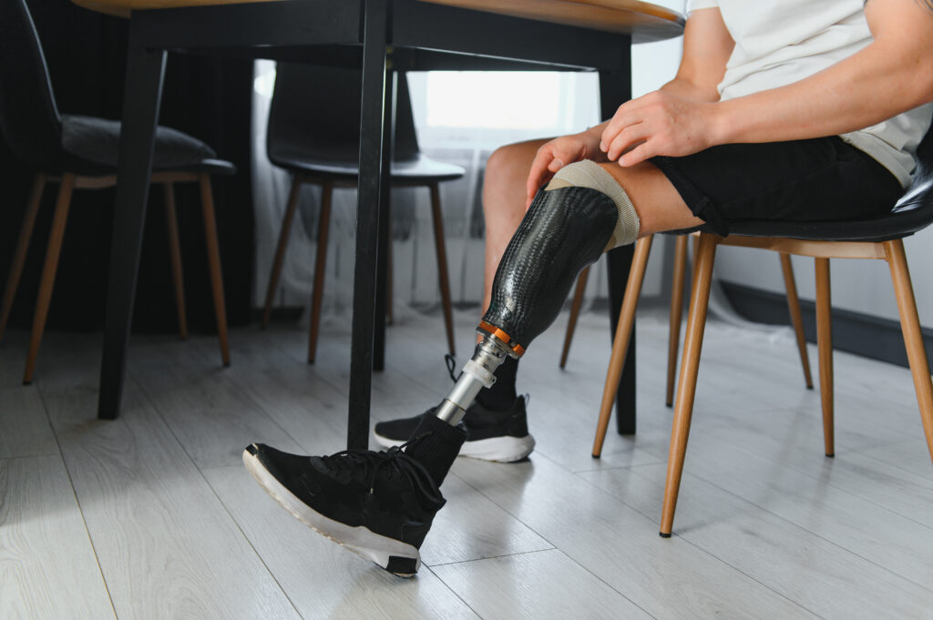 Person sitting at home adjusting prosthetic leg, highlighting daily prosthetic care and comfort management