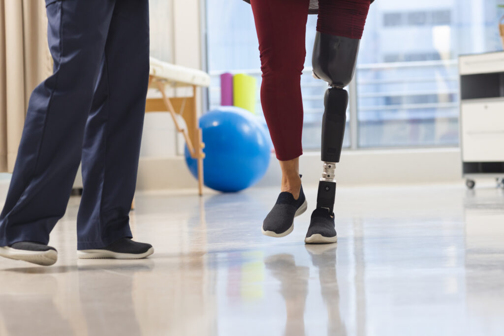 Patient walking with therapist during rehabilitation session focused on prosthetic care and mobility improvement