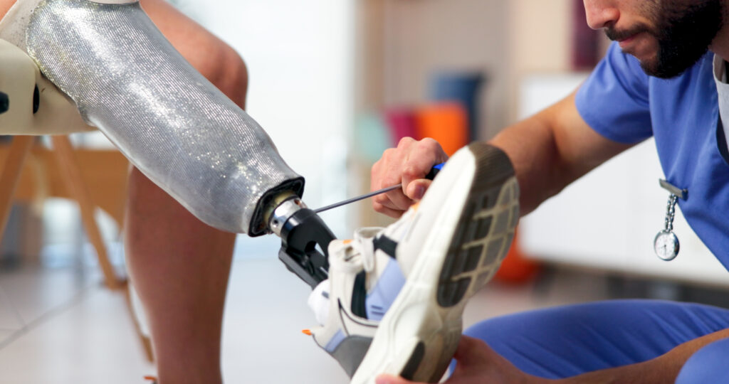 Clinician adjusting prosthetic foot during fitting, demonstrating hands on prosthetic care and precision alignment